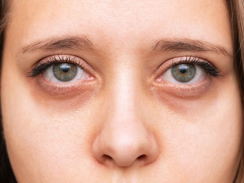 Cirurgia de Retina e Catarata em Curitiba